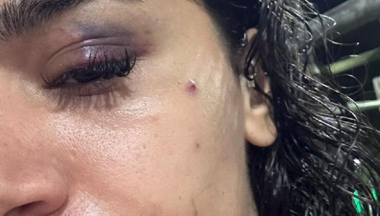 Ebru hemşirenin sesini duyun! “Ölmeden önce…”