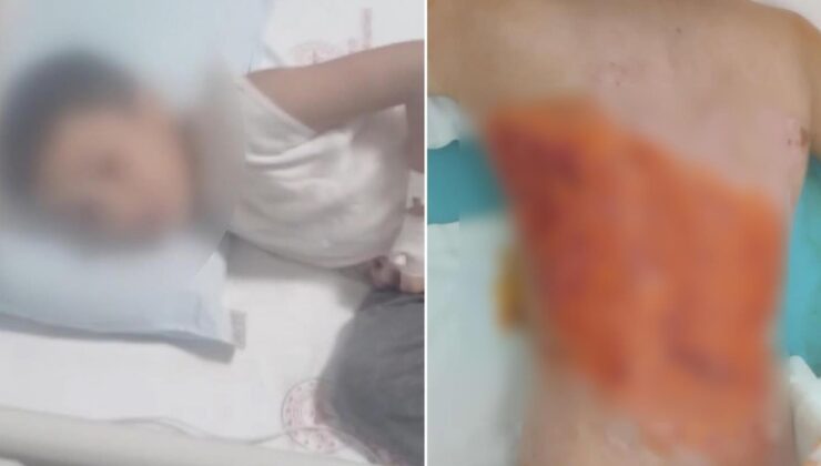 12 yaşındaki çocuğu diri diri yaktılar! Sonrası daha da korkunç